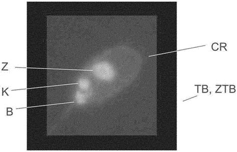 Method for detecting a binding of antibodies from a patient sample to ...