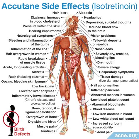 Accutane Side effects - Spud Diet? - Page 3 - Discussion | Ideas ...