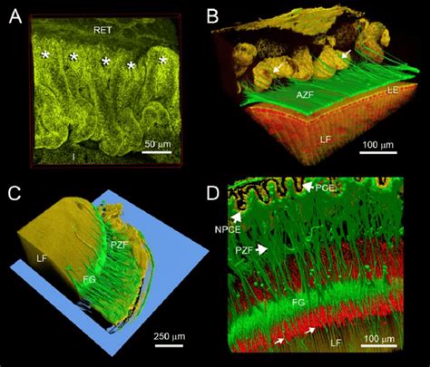 Origin and termination points of zonular fibers in the mouse eye. En ...