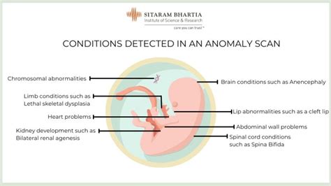 How an Anomaly Scan Helps & Why You Need It - Sitaram Bhartia Blog