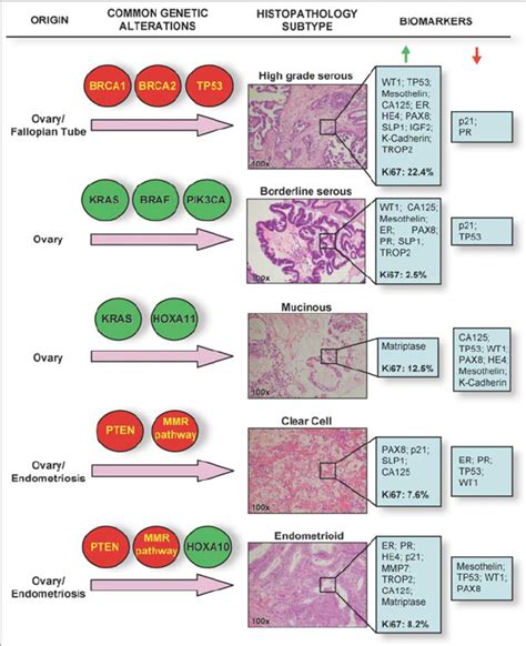 Histological and Molecular Heterogeneity in Epithelial Ovarian Cancers ...