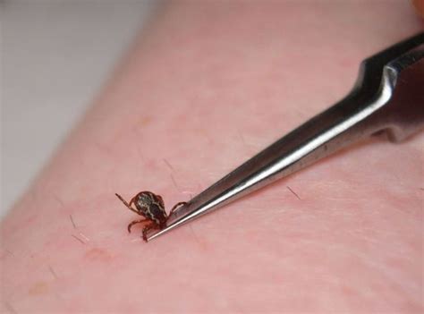 Tips on Tick Removal – Lyme Ontario