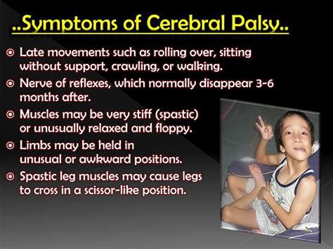 Cerebral Palsy Symptoms