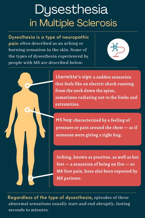 Dysesthesia in MS | Feeling, Causes, and Treatment | Multiple Sclerosis ...