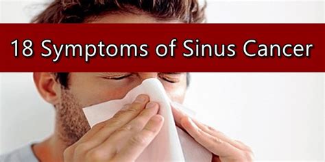 Sinus Cancer Symptoms | NewsFeed