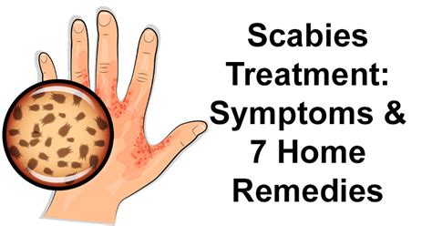 Scabies Rash Chest