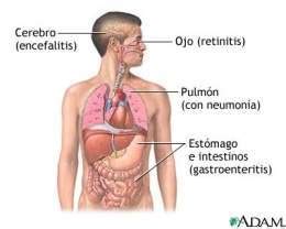 Citomegalovirus - EcuRed