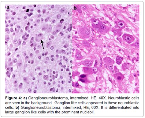 Ganglion Cells Histology