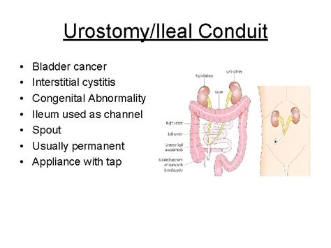 Essential Stoma Care Catherine Murray Lead Stoma Care