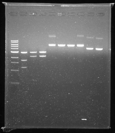 biochemistry - How do I interpret the results of this DNA gel ...