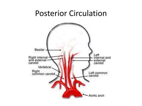 PPT - Cerebral Angiography PowerPoint Presentation - ID:154664