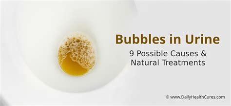 Bubbles in Urine: 9 Possible Causes and Natural Treatments