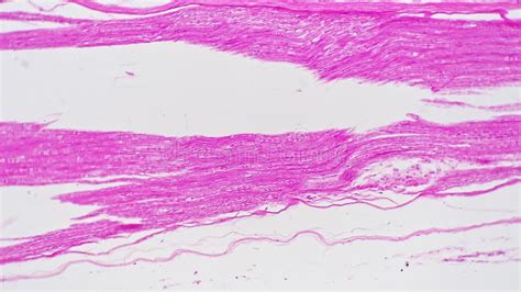 Nerves Trunk in Longitudinal Section Filmed Under Lab Microscope with ...