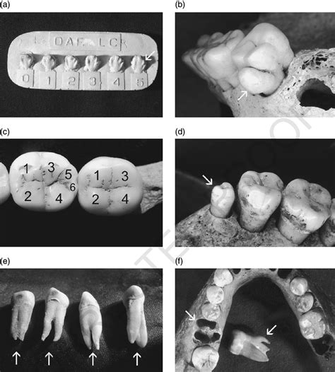 4 Morphological crown and root traits. (a) ASUDAS plaque showing 0 and ...