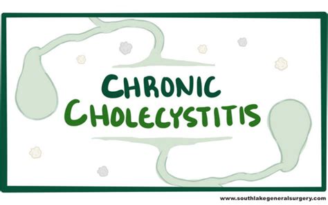 Chronic Cholecystitis- Causes, Symptoms, and Treatment - Southlake ...