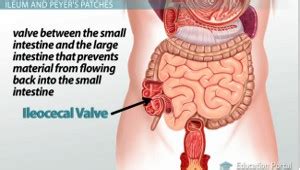 Ileocecal Valve Dysfunction Contributes to SIBO – SIBO Guru