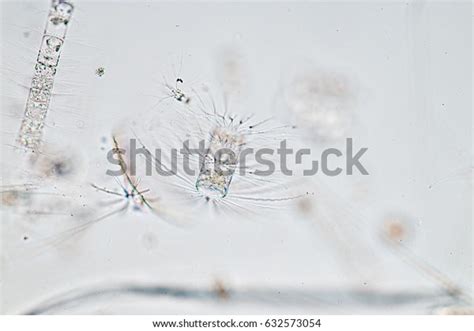 Chaetoceros Diatom Under Microscope View Stock Photo 632573054 ...