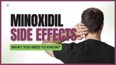 Minoxidil Side Effects: What You Need to Know | Care Well Medical Centre