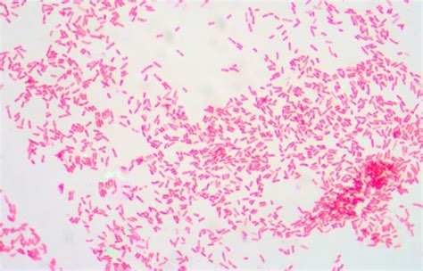 Gram-Negative Bacilli SSTIs on the Rise in Patients With Diabetes ...