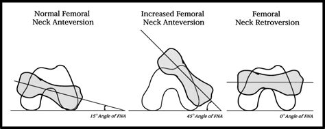 Do you know your Torsions? If so, then you here is what you need to ...