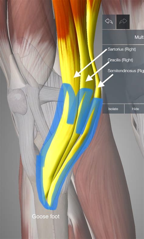 Pes anserine bursitis - dnbinger