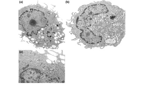 Transmission electron microscopy (TEM) images of macrophages upon ...