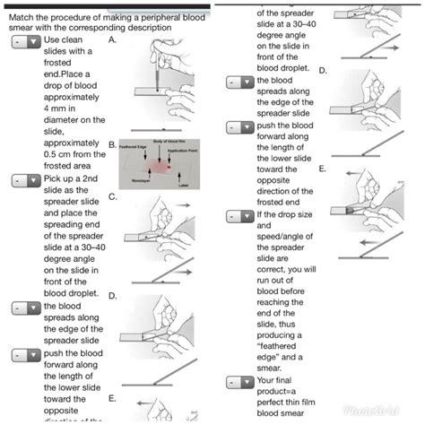 Peripheral Blood Smear Staining Procedure