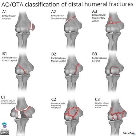 Distal Humerus Anatomy