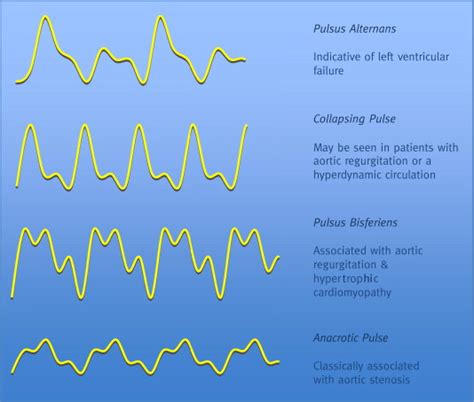 Monitoring central venous pressure, arterial pressure and pulmonary ...