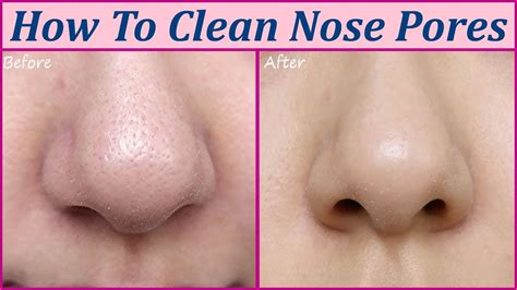 Pin by Jeanette Sharp on Makeup Morgue | Nose pores, Clean nose pores ...