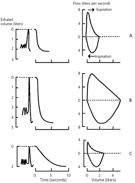 An Approach to Interpreting Spirometry | AAFP