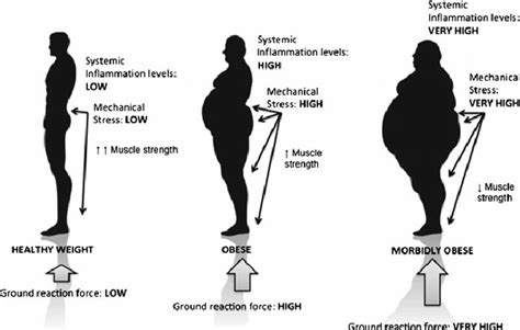 Belly Fat Can Cause Back Pain and Injury - Sciatica Clinic