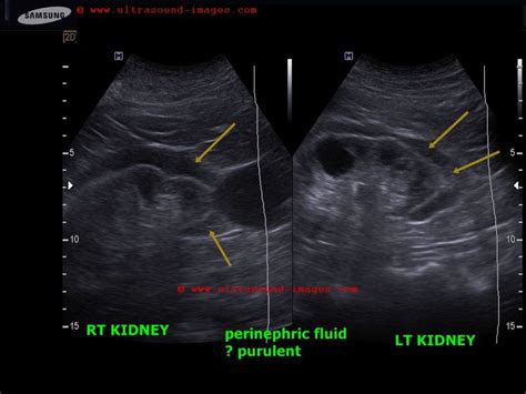 A Gallery of High-Resolution, Ultrasound, Color Doppler & 3D Images ...