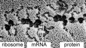 Ribosomes Electron Micrograph