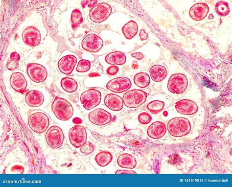 Echinococcal Cyst Under the Microscope 400x. Echinococcus Granulosus ...