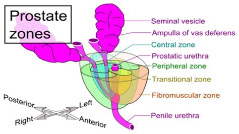 Cancer de la prostate : Voici les 8 traitements médicaux en détails