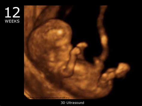 30 weeks pregnant 3d ultrasound - vividpadi