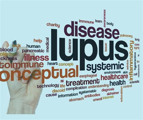 Understanding Lupus: The available treatments you didn´t know| London