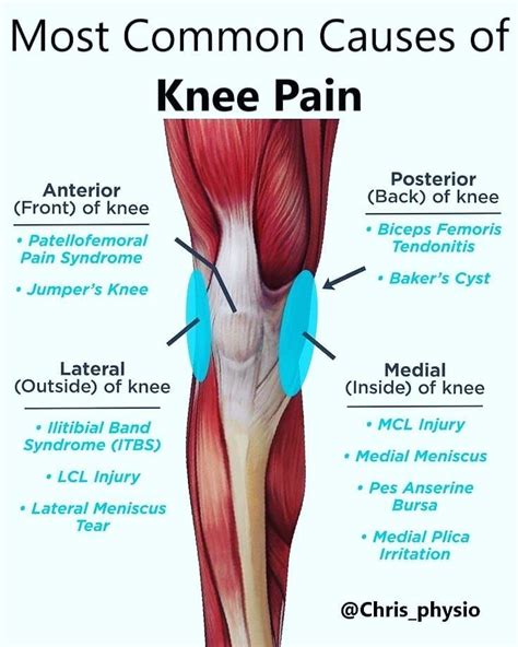 If you have knee pain maybe the photo will help you figure out what may ...