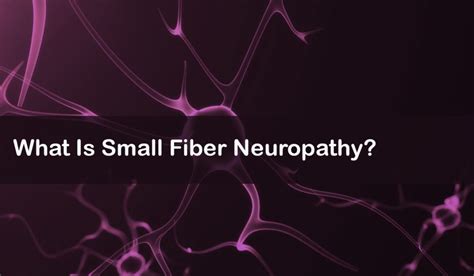 What Is Small Fiber Neuropathy: Symptoms, Treatment, Causes, and More