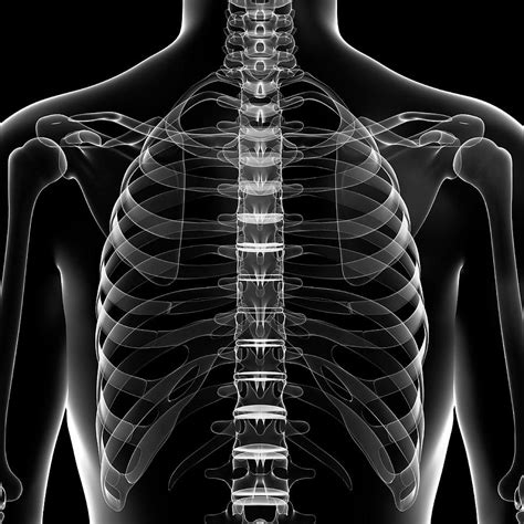 Chest Bones Photograph by Pixologicstudio/science Photo Library - Fine ...