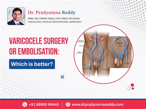 Varicocele Surgery or Embolization ? Which is better