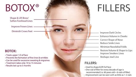 Botox and 5 other best dermal fillers