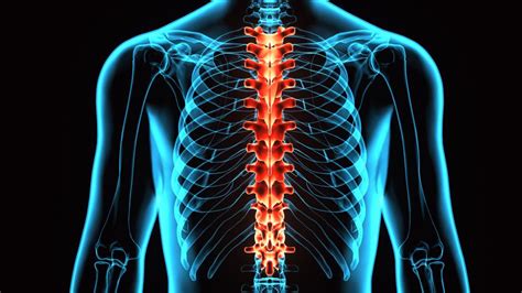 Spinal stroke: Symptoms, causes, recovery, and prognosis