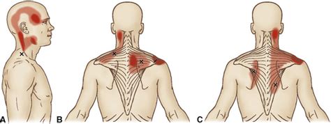 muscles de la ceinture scapulaire