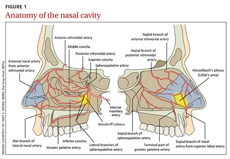 Epistaxis: A guide to assessment and management | MDedge Family Medicine