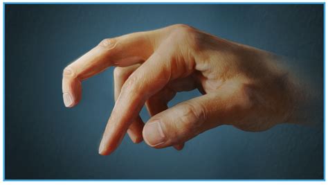 Part 1: Series- Finger Joint Injuries and Extensor Tendon Ruptures/Sprains