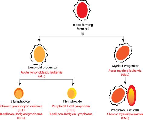 Origin of different subtypes of blood cancer (red) with respective ...