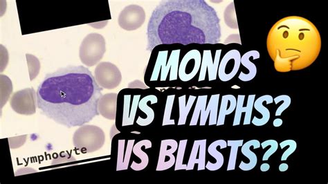 How I distinguish between Lymphocytes vs Monocytes - YouTube