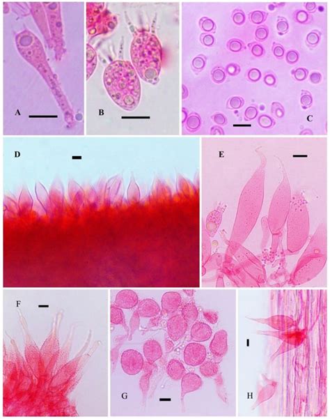 A Normal basidium. B Short basidia. C Basidiospores. D Lamella edge ...